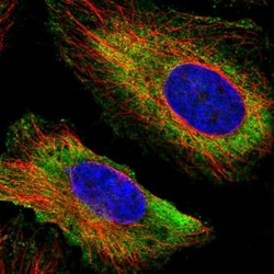 DYX1C1 Antibody, Novus Biologicals 25 &mu;L; Unlabeled:Antibodies, Polyclonal